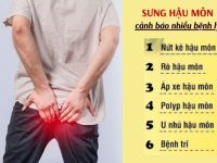 Dấu hiệu sưng hậu môn là bị gì?