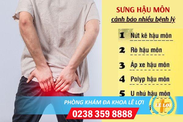 Dấu hiệu sưng hậu môn là bị gì?