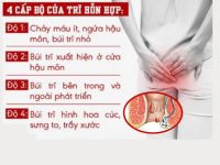 Dấu hiệu và cách điều bệnh trị trĩ hỗn hợp hiệu quả