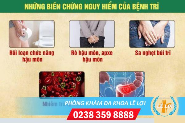 Giai-dap-benh-tri-co-nguy-hiem-khong-tu-chuyen-gia