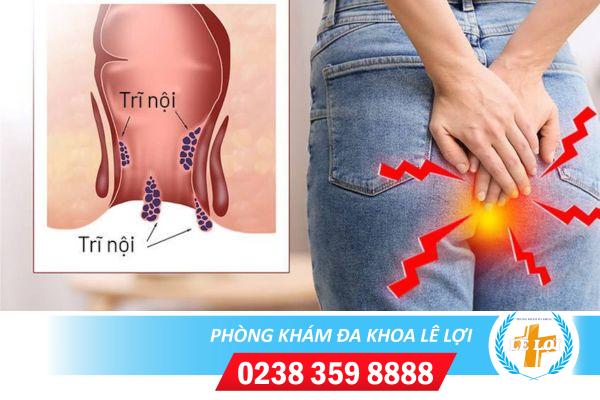 Phòng khám chữa bệnh trĩ uy tín tại Vinh