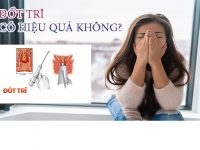 Đốt trĩ hiệu quả không chi phí bao nhiêu?