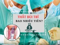 Chi phí thắt búi trĩ bao nhiêu tiền?