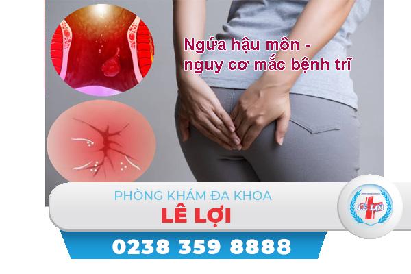 Ngứa hậu môn có phải do bệnh trĩ?