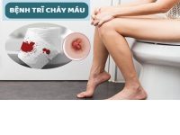 Bệnh trĩ chảy máu nguy hiểm không phải làm sao?