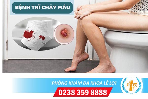 Bệnh trĩ chảy máu nguy hiểm không phải làm sao?