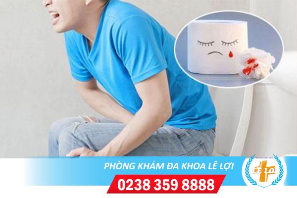 Đi vệ sinh ra máu đau rát hậu môn là bệnh gì?