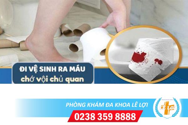 Đi vệ sinh ra máu nguyên nhân và cách điều trị