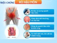 Địa chỉ và chi phí chữa rò hậu môn