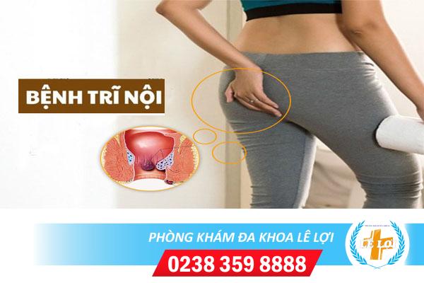 Cách chữa bệnh trĩ nội tại nhà hiệu quả