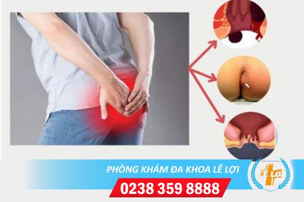 Đau lỗ hậu môn phải làm sao?