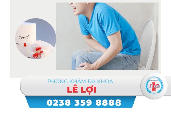 Táo bón đi cầu ra máu là bệnh gì nguy hiểm không?