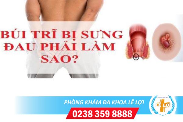 Đau búi trĩ phải làm sao?